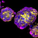 ابداع نانوکریستال های سلولزی برای بهبود دارو رسانی و درمان سرطان